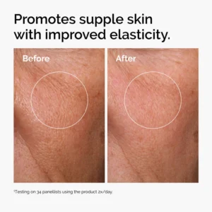 سرم آبرسان هیالورونیک اسید و ویتامین B5 اوردینری